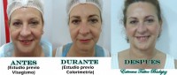 /album/micropigmentacion/micropigmentacion-en-badajoz-jpg/